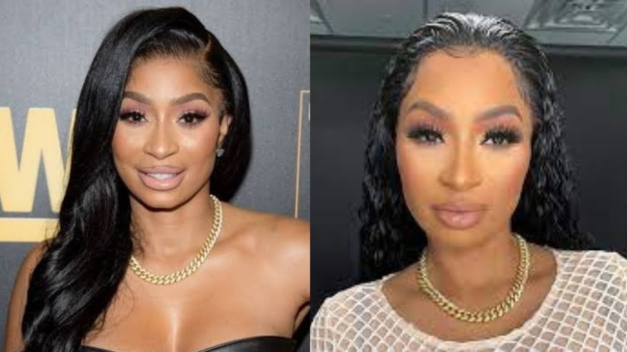 Karlie Redd New Face & Plastic Surgery: Before After Photos Hints Its More Than Lip Injections