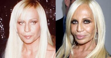Donatella Versace Before And After Plastic Surgery Photos: Transformation Photos Exposed!
