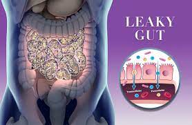 1 Best Drink for Leaky Gut: New Study Suggests