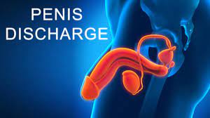White Discharge In Men: What Causes Unusual Penis Discharge?