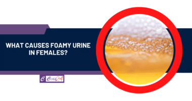 What causes foamy urine in females?