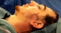 Dzhokhar Tsarnaev Eye Injury: What Happen To Him? Health Update