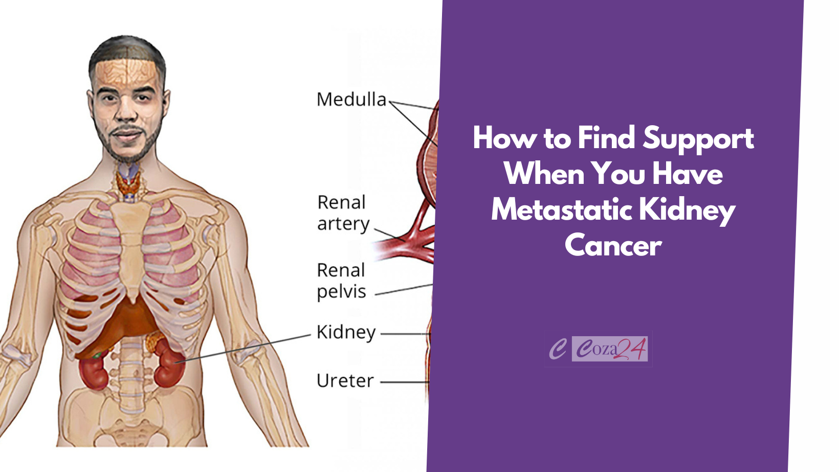 How to Find Support When You Have Metastatic Kidney Cancer