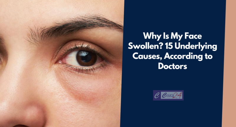 Why Is My Face Swollen? 15 Underlying Causes, According to Doctors