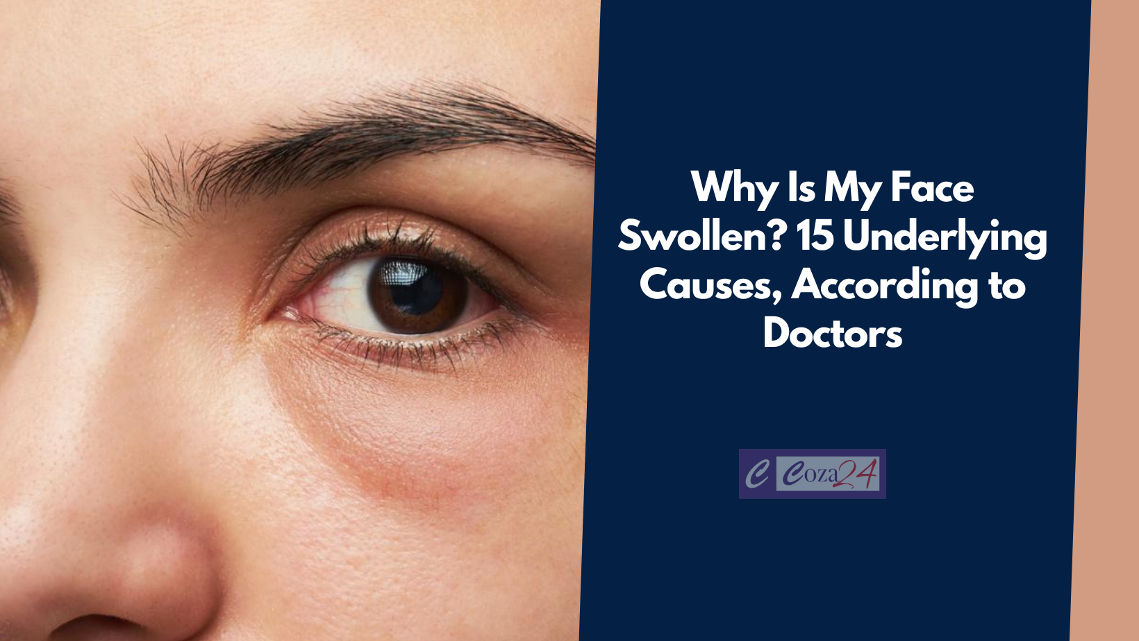 Why Is My Face Swollen? 15 Underlying Causes, According to Doctors
