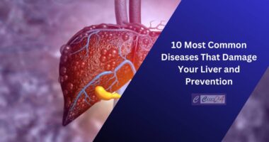 10 Most Common Diseases That Damage Your Liver and Prevention