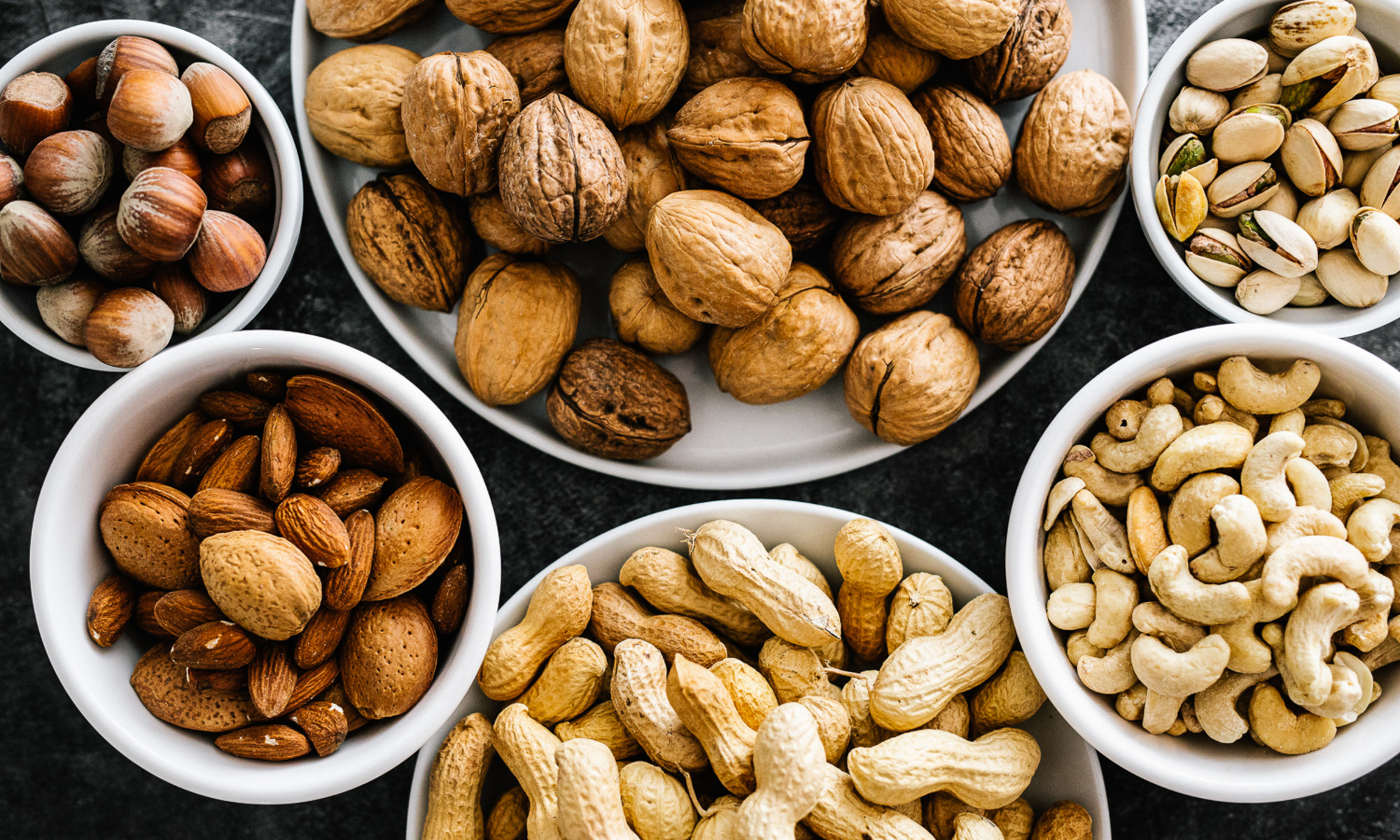 7 Best Healthy Nuts That Can Improve Memory Retention Easily