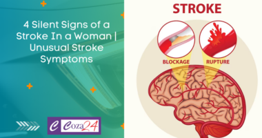 4 Silent Signs of a Stroke In a Woman Unusual Stroke Symptoms