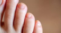 Here's How To Keep Your Toenails Healthy