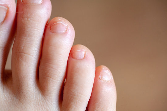 Here's How To Keep Your Toenails Healthy