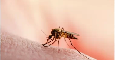 How To Take Care Of A Malaria Patient
