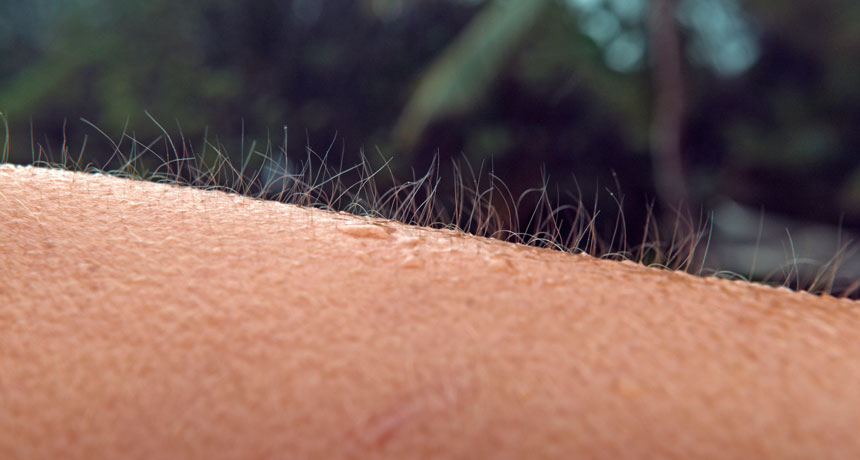 Can Body Hair Indicate Health Problems?