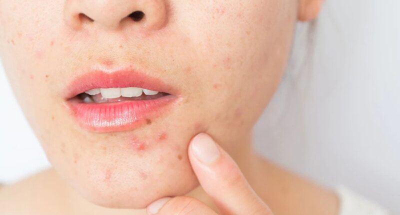 7 Skincare Mistakes That Damage Your Skin