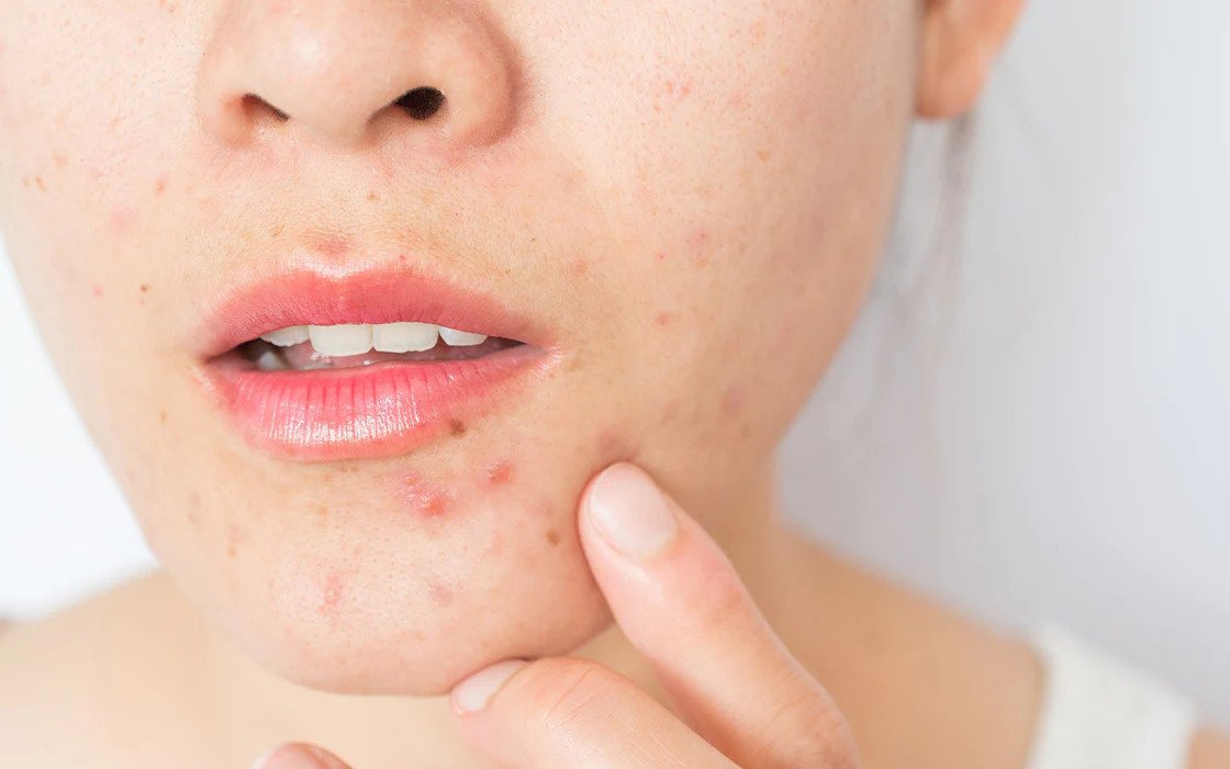 7 Skincare Mistakes That Damage Your Skin