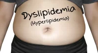 Diabetic Dyslipidemia Signs and Symptoms: Types, Causes, Risk Factors, and Treatment