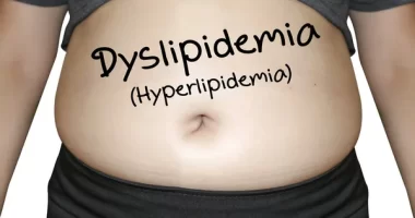 Diabetic Dyslipidemia Signs and Symptoms: Types, Causes, Risk Factors, and Treatment