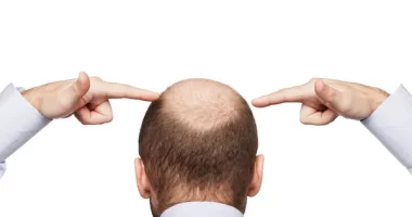 Hair Shedding vs Hair Loss Treatment Dermatologist: The Difference Explained