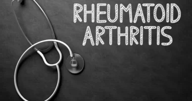 Rheumatoid Arthritis Inflammation: 5 Effective Treatment Options for Arthritis-Induced Joint Pain