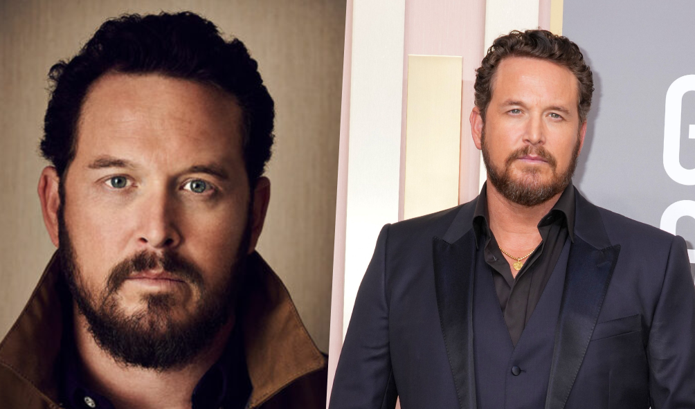 Did Cole Hauser Undergo Plastic Surgery? Everything You Need To Know!