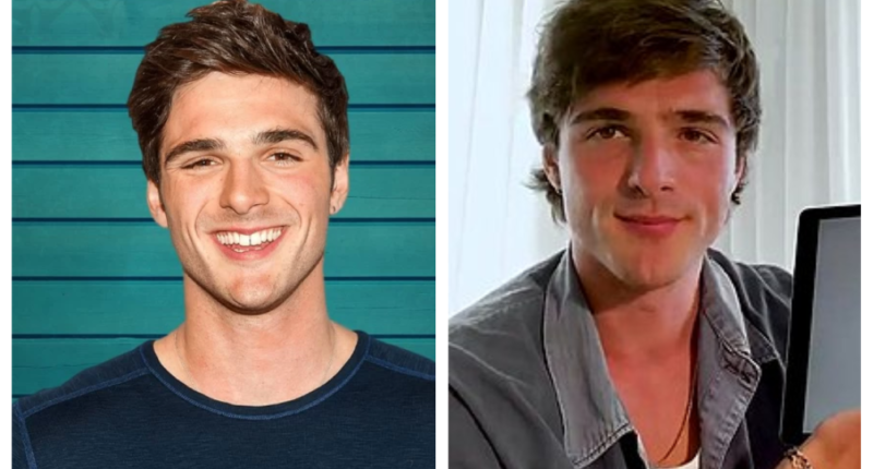 Did Jacob Elordi Get a Nose Job Done? Plastic Surgery Before And After