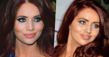 Has Amy Childs Get Plastic Surgery Done?