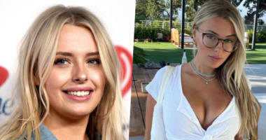 Has Corinna Kopf Get Plastic Surgery Done? Before and After Photos