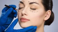 What To Know Before And After Eyelid Surgery (Blepharoplasty)?