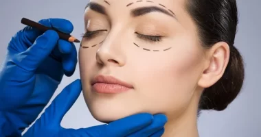 What To Know Before And After Eyelid Surgery (Blepharoplasty)?