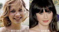 Has Actress Zooey Deschanel Done Plastic Surgery Or Not?