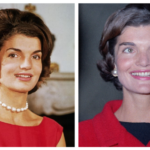 What Happened To Jackie Kennedy Teeth? Net Worth Explored