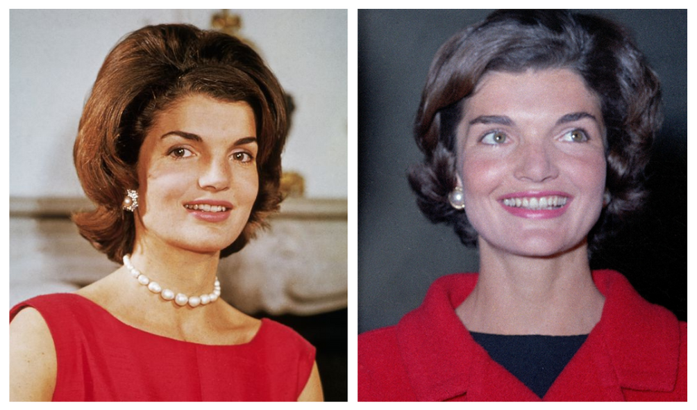 What Happened To Jackie Kennedy Teeth? Net Worth Explored