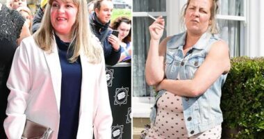 Did Karen Taylor From EastEnders Undergo Weight Loss Surgery? Before And After Photos